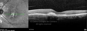 o26-ti03-16224-20110906-014