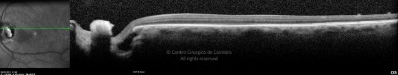 o27-ti03-22230-20110622-025