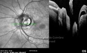 o34-ti03-22230-20120104-033