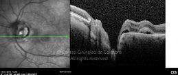 o34-ti03-22230-20120112-032