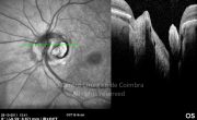 o35-ti03-22230-20111028-016