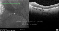 o38-ti03-2156701-20120417-024