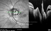 o38-ti03-22230-20120104-037