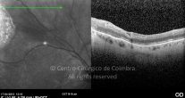 o39-ti03-2156701-20120417-025