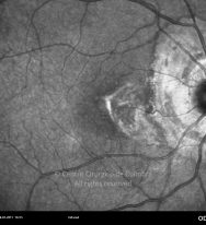 o56-ti16-132073-20110728-006