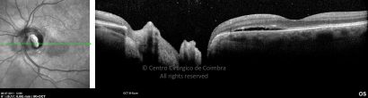 o62-ti03-22230-20110708-019