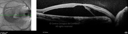 o68-ti03-2150201-20110713-006