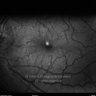 o01-ti01-18437-20110328-001