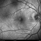 o01-ti01-3124-20110222-001
