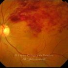 o01-ti02-105181-20080609-001