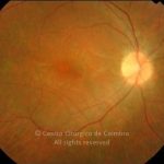 o01-ti02-16129-20060712-001