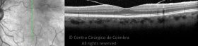 o01-ti03-105320-20110824-021