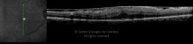 o01-ti03-131397-20100331-001