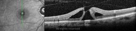 o01-ti03-2136205-20100622-001