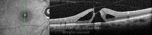 o01-ti03-2136205-20100622-001