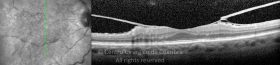 o01-ti03-2155822-20111216-001