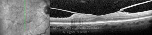 o01-ti03-2155822-20111216-001