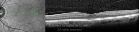 o01-ti03-2157305-20120323-013
