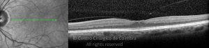 o01-ti03-2157305-20120323-013
