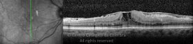 o01-ti03-2160709-20120509-007