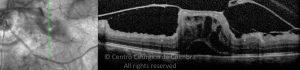 o01-ti03-2171129-20130326-022