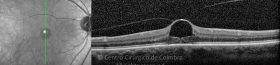 o01-ti03-2189941-20140819-005