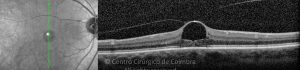 o01-ti03-2189941-20140819-005
