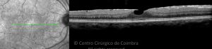 o01-ti03-2208576-20151020-001