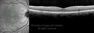 o01-ti03-2208576-20160907-001