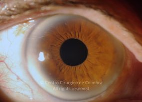 o01-ti12-3124-20110429-001