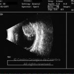 o01-ti23-2163384-20120706-002