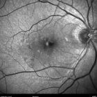 o02-ti01-3124-20110617-001