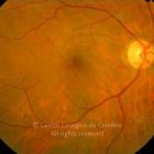 o02-ti02-11941-20080317-001