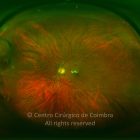 o02-ti02-2098-20120106-999