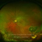 o02-ti02-2160324-20120420-998