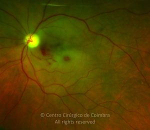 o02-ti02-2162333-20120605-999