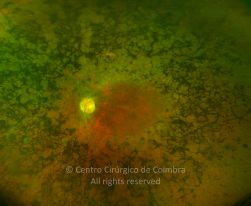 o02-ti02-2179216-20141103-002
