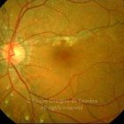 o02-ti02-24087-20070928-002