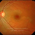 o02-ti02-3251-20081015-001