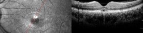 o02-ti03-121746-20090825-003