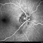 o02-ti07-15580-20130926-250