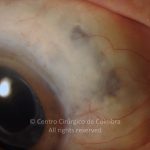 o02-ti12-1621-20110706-002