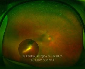o02-ti12-2192338-20141015-007