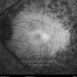 o02-ti15-131915-20100409-005