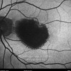 o02-ti15-2149554-20110607-002