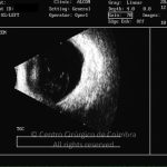o02-ti23-130449-20100428-001