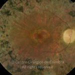 o03-ti02-2179216-20141103-002