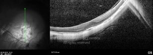 o03-ti03-4870-20100920-001