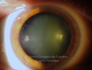 o03-ti12-2159896-20120410-003