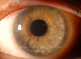 o03-ti12-4870-20100929-001
